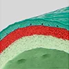 Case Thumb Image